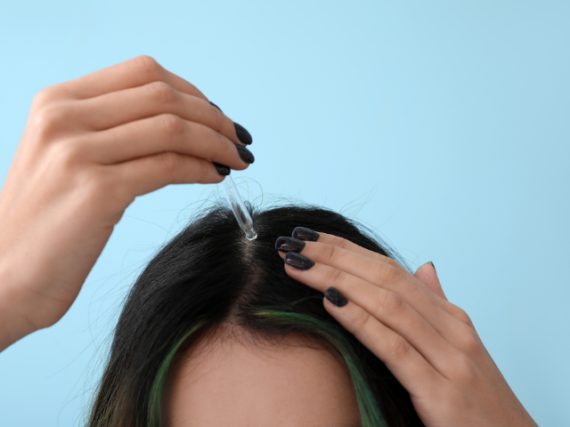 Addressing Androgenic Alopecia with Compounded Solutions