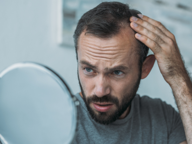 Man experiencing Androgenic Alopecia